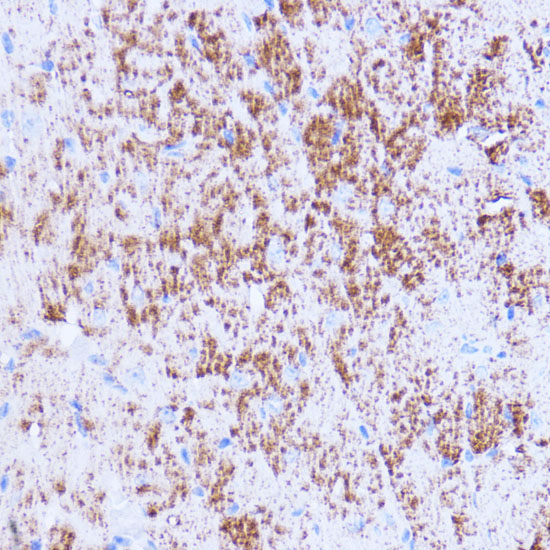 Immunohistochemistry of paraffin-embedded mouse heart using SIRT3 Polyclonal Antibody at dilution of 1:100 (40x lens).Perform microwave antigen retrieval with 10 mM PBS buffer pH 7.2 before commencing with IHC staining protocol.