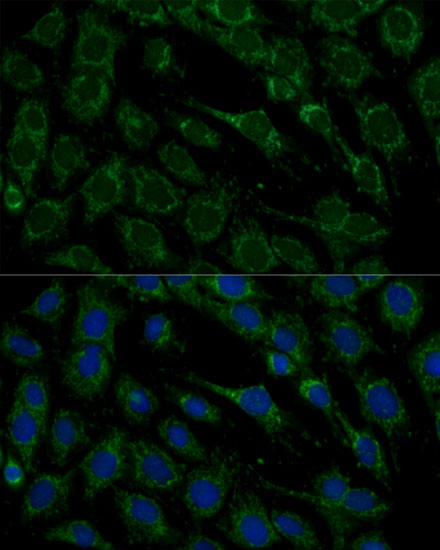 Immunofluorescence analysis of C6 cells using FXN / Frataxin Polyclonal Antibody at dilution of 1:100. Blue: DAPI for nuclear staining.