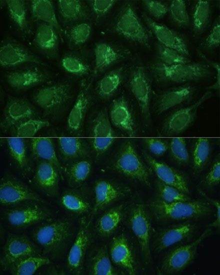 Immunofluorescence analysis of U2OS cells using FXN / Frataxin Polyclonal Antibody at dilution of 1:100. Blue: DAPI for nuclear staining.