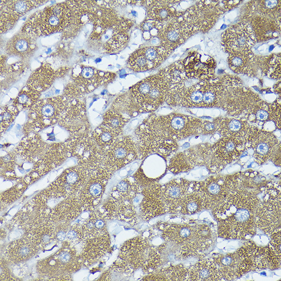Immunohistochemistry of paraffin-embedded human liver using FXN / Frataxin Polyclonal Antibody at dilution of 1:100 (40x lens).Perform high pressure antigen retrieval with 10 mM citrate buffer pH 6.0 before commencing with IHC staining protocol.