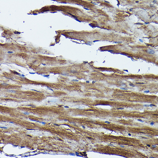 Immunohistochemistry of paraffin-embedded mouse heart using FXN / Frataxin Polyclonal Antibody at dilution of 1:100 (40x lens).Perform high pressure antigen retrieval with 10 mM citrate buffer pH 6.0 before commencing with IHC staining protocol.