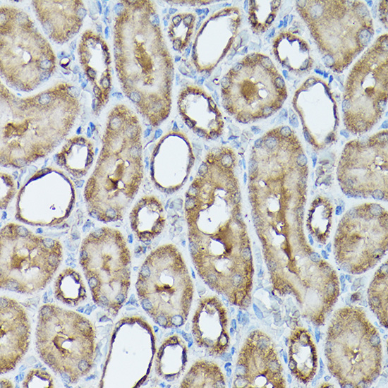 Immunohistochemistry of paraffin-embedded rat kidney using FXN / Frataxin Polyclonal Antibody at dilution of 1:100 (40x lens).Perform high pressure antigen retrieval with 10 mM citrate buffer pH 6.0 before commencing with IHC staining protocol.