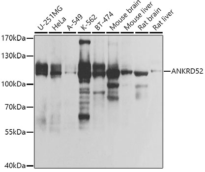 Western blot analysis of extracts of various cell lines using ANKRD52 Polyclonal Antibody at 1:1000 dilution.