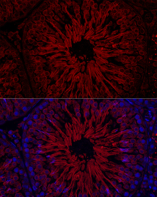 Immunofluorescence analysis of rat testis cells using GPX4 Polyclonal Antibody at dilution of 1:200 (40x lens). Blue: DAPI for nuclear staining.