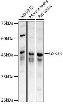 Western blot analysis of extracts of various cell lines using GSK3β Polyclonal Antibody at 1:1000 dilution.