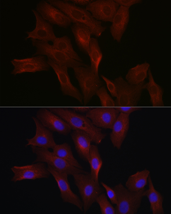 Immunofluorescence analysis of A-549 cells using HMGCR Polyclonal Antibody at dilution of 1:200 (40x lens). Blue: DAPI for nuclear staining.