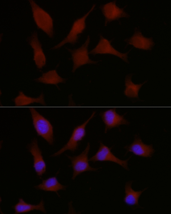 Immunofluorescence analysis of HeLa cells using HMGCR Polyclonal Antibody at dilution of 1:200 (40x lens). Blue: DAPI for nuclear staining.