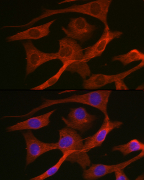 Immunofluorescence analysis of NIH/3T3 cells using HMGCR Polyclonal Antibody at dilution of 1:200 (40x lens). Blue: DAPI for nuclear staining.