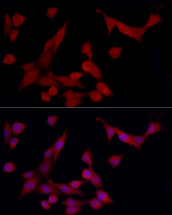 Immunofluorescence analysis of PC-12 using Heme Oxygenase 1 Polyclonal Antibody at dilution of 1 : 50 (40x lens). Blue: DAPI for nuclear staining.