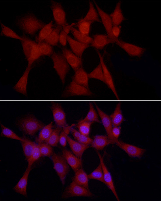 Immunofluorescence analysis of NIH-3T3 using Heme Oxygenase 1 Polyclonal Antibody at dilution of 1 : 50 (40x lens). Blue: DAPI for nuclear staining.