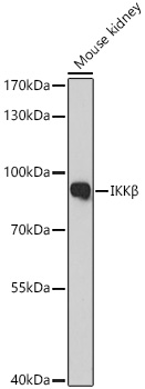 Western blot analysis of Mouse kidney using IKKβ Polyclonal Antibody at 1:1000 dilution.