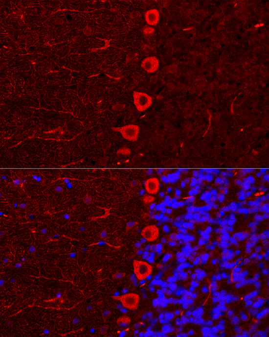 Immunofluorescence analysis of U2OS cells using IP3R Polyclonal Antibody at dilution of 1:100. Perform microwave antigen retrieval with 10 mM citrate buffer pH 6.0 before commencing with IF staining protocol. Blue: DAPI for nuclear staining.