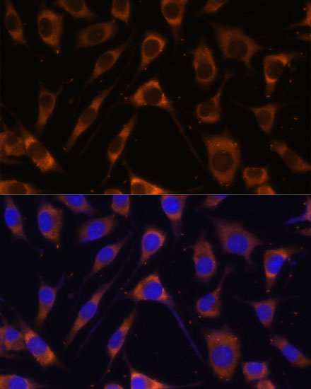 Immunofluorescence analysis of L929 cells using Laminin beta 1 Polyclonal Antibody at dilution of 1:100 (40x lens). Blue: DAPI for nuclear staining.