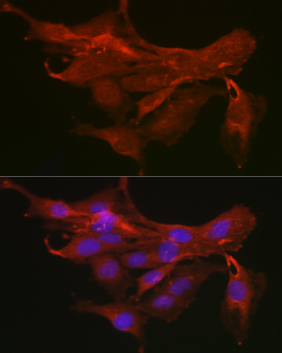 Immunofluorescence analysis of C6 cells using [KO Validated] MyD88 Polyclonal Antibody at dilution of 1:200 (40x lens). Blue: DAPI for nuclear staining.