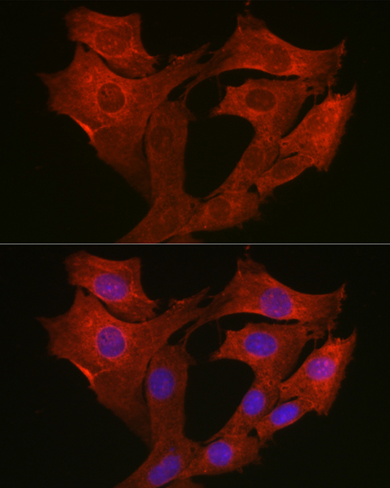 Immunofluorescence analysis of NIH/3T3 cells using [KO Validated] MyD88 Polyclonal Antibody at dilution of 1:200 (40x lens). Blue: DAPI for nuclear staining.