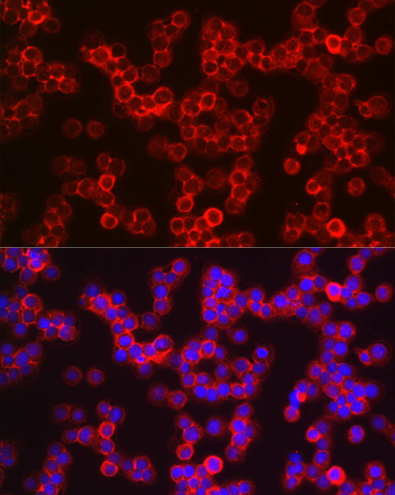 Immunofluorescence analysis of Jurkat cells using Notch1 Polyclonal Antibody at dilution of 1:250 (40x lens). Blue: DAPI for nuclear staining.