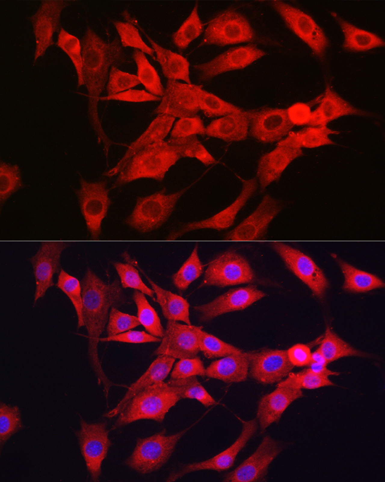 Immunofluorescence analysis of NIH/3T3 cells using Notch1 Polyclonal Antibody at dilution of 1:200 (40x lens). Blue: DAPI for nuclear staining.