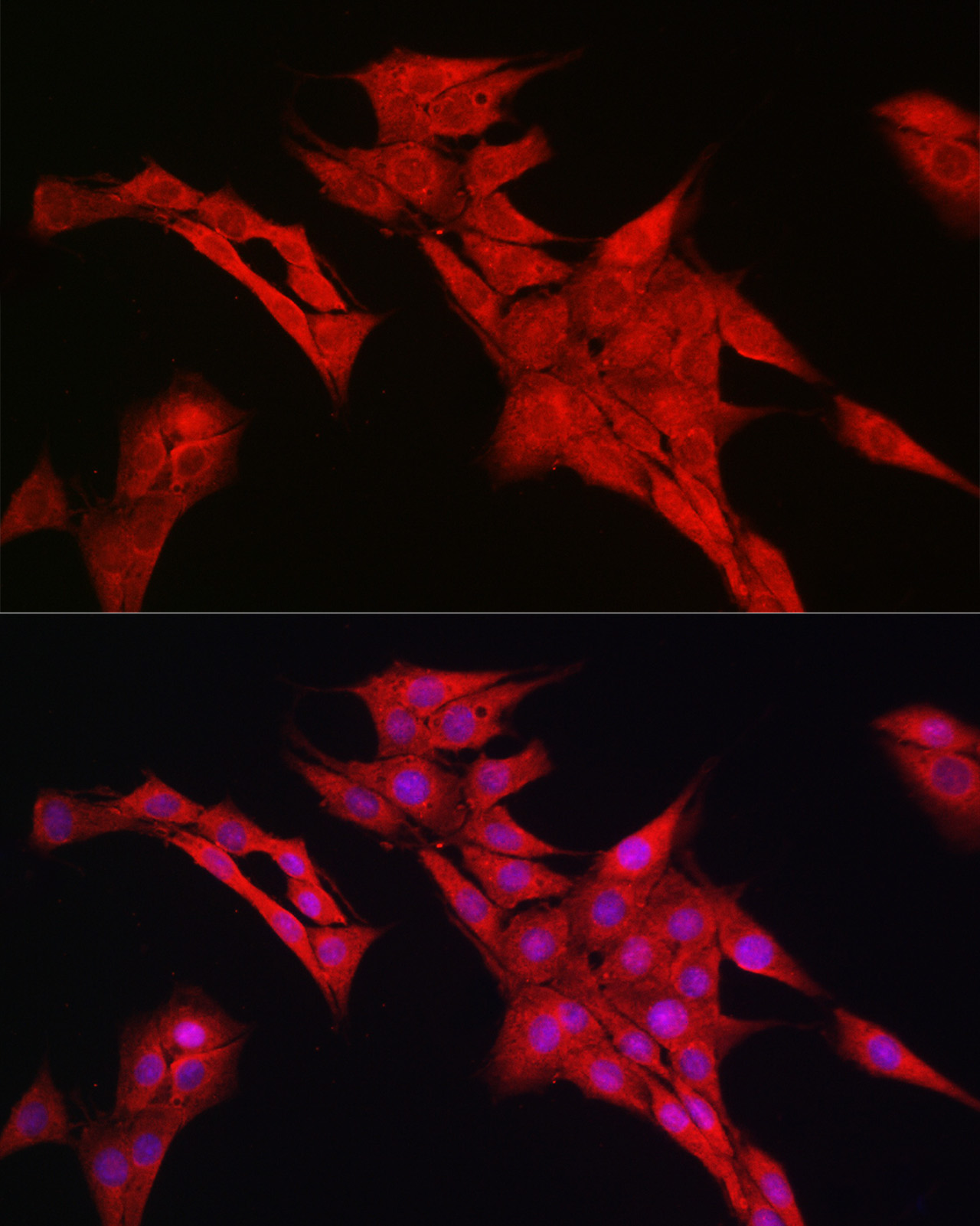 Immunofluorescence analysis of PC-12 cells using Notch1 Polyclonal Antibody at dilution of 1:200 (40x lens). Blue: DAPI for nuclear staining.