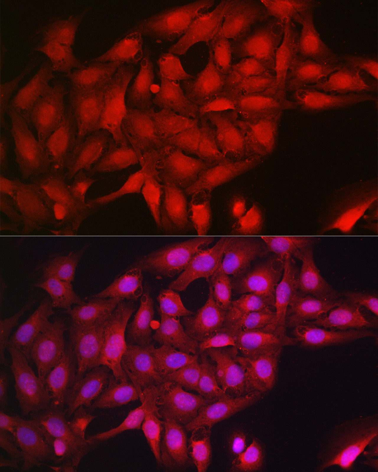 Immunofluorescence analysis of U2OS cells using Notch1 Polyclonal Antibody at dilution of 1:200 (40x lens). Blue: DAPI for nuclear staining.