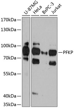 Western blot analysis of extracts of various cell lines using PFKP Polyclonal Antibody at 1:3000 dilution.