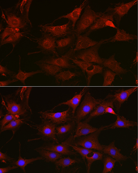 Immunofluorescence analysis of C6 cells using [KO Validated] Rac1/2/3 Polyclonal Antibody at dilution of 1:100 (40x lens). Blue: DAPI for nuclear staining.