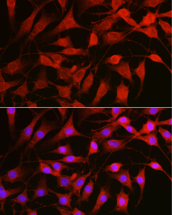 Western blot analysis of extracts from wild type (WT) and TOLLIP knockdown (KD) 293T cells using TOLLIP Polyclonal Antibody at 1:500 dilution.