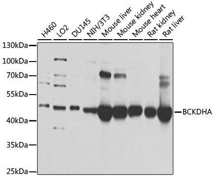 Western blot analysis of extracts of various cell lines using BCKDHA Polyclonal Antibody at 1:1000 dilution.