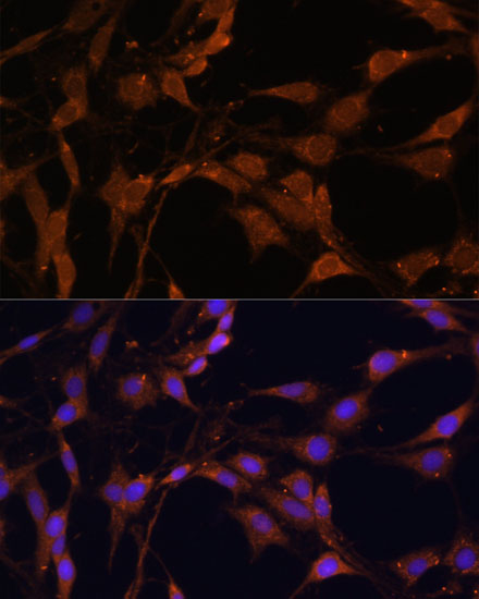 Immunofluorescence analysis of C6 cells using Bcl-2 Polyclonal Antibody at dilution of 1:100. Blue: DAPI for nuclear staining.