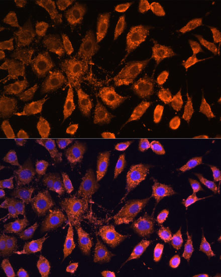 Immunofluorescence analysis of L929 cells using Bcl-2 Polyclonal Antibody at dilution of 1:100. Blue: DAPI for nuclear staining.