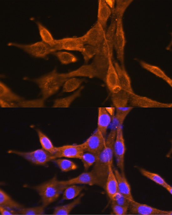 Immunofluorescence analysis of NIH/3T3 cells using Bcl-2 Polyclonal Antibody at dilution of 1:100 (40x lens). Blue: DAPI for nuclear staining.