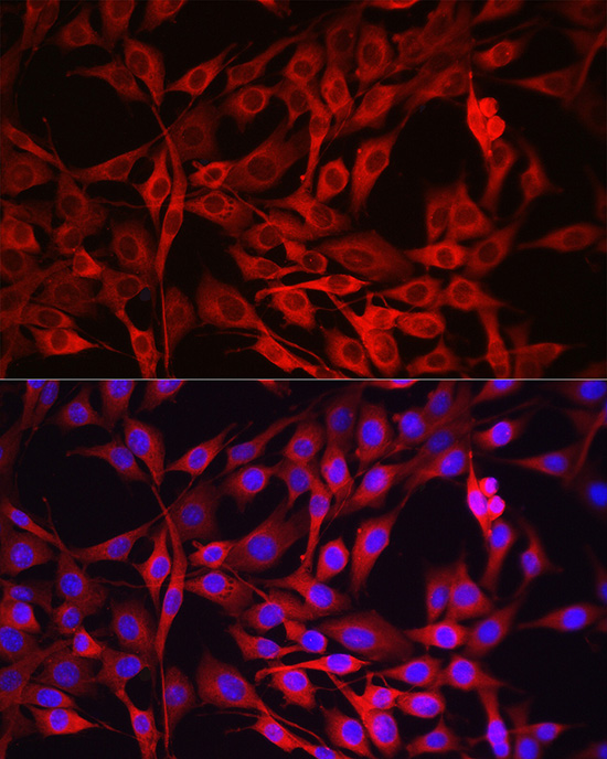 Immunofluorescence analysis of NIH/3T3 cells using NF-kB p65/RelA Polyclonal Antibody at dilution of 1:100 (40x lens). Blue: DAPI for nuclear staining.