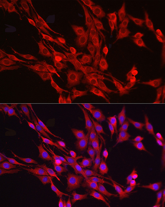 Immunofluorescence analysis of PC-12 cells using NF-kB p65/RelA Polyclonal Antibody at dilution of 1:100 (40x lens). Blue: DAPI for nuclear staining.