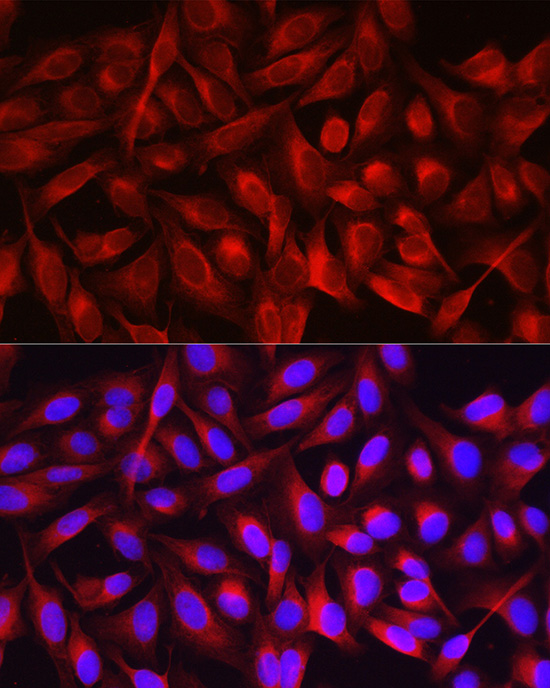 Immunofluorescence analysis of U2OS cells using NF-kB p65/RelA Polyclonal Antibody at dilution of 1:100 (40x lens). Blue: DAPI for nuclear staining.