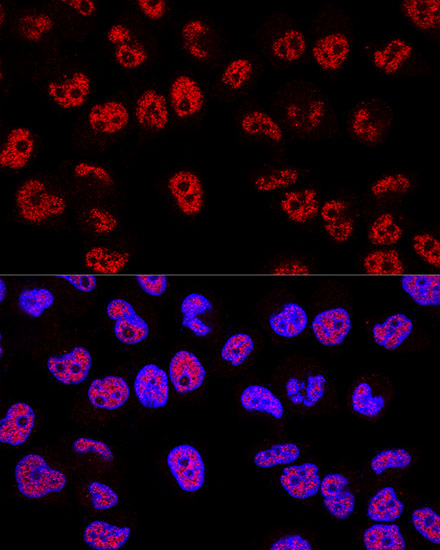 Confocal immunofluorescence analysis of Hela cells using p53 Polyclonal Antibody at dilution of 1:200. Blue: DAPI for nuclear staining.