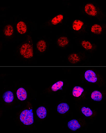 Confocal immunofluorescence analysis of U2OS cells using p53 Polyclonal Antibody at dilution of 1:200. Blue: DAPI for nuclear staining.