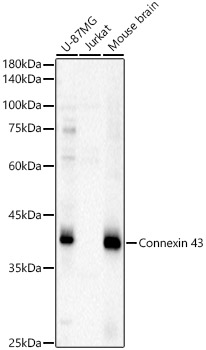 Western blot analysis of extracts of various cell lines using Connexin 43 Polyclonal Antibody at 1:500 dilution.
