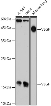 Western blot analysis of extracts of various cell lines using VEGF Polyclonal Antibody at 1:1000 dilution.