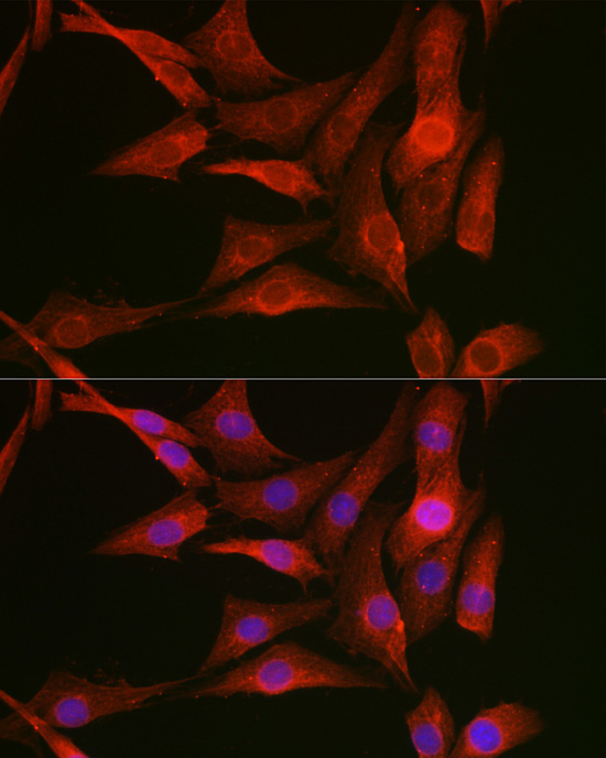 Immunofluorescence analysis of NIH-3T3 cells using Vimentin Polyclonal Antibody at dilution of 1:50 (40x lens). Blue: DAPI for nuclear staining.