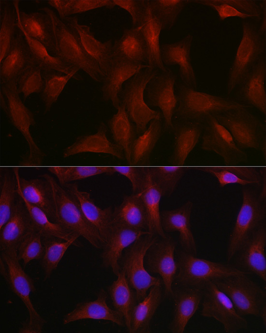 Immunofluorescence analysis of U2OS cells using Vimentin Polyclonal Antibody at dilution of 1:50 (40x lens). Blue: DAPI for nuclear staining.