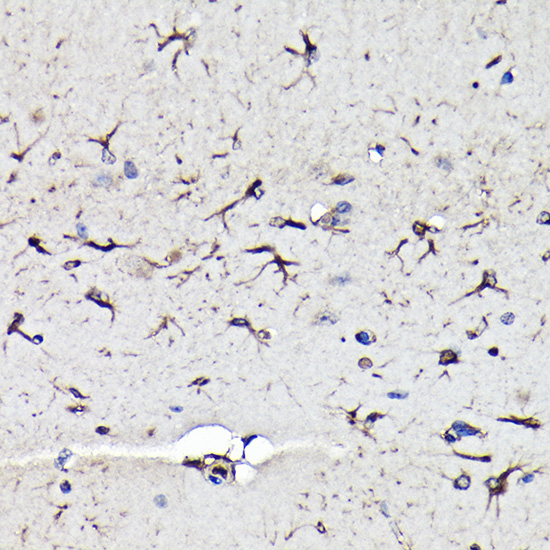 Immunohistochemistry of paraffin-embedded mouse brain using Vimentin Polyclonal Antibody at dilution of 1:100 (40x lens).Perform high pressure antigen retrieval with 10 mM citrate buffer pH 6.0 before commencing with IHC staining protocol.