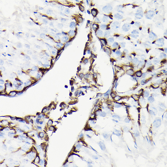 Immunohistochemistry of paraffin-embedded rat testis using Vimentin Polyclonal Antibody at dilution of 1:100 (40x lens).Perform high pressure antigen retrieval with 10 mM citrate buffer pH 6.0 before commencing with IHC staining protocol.