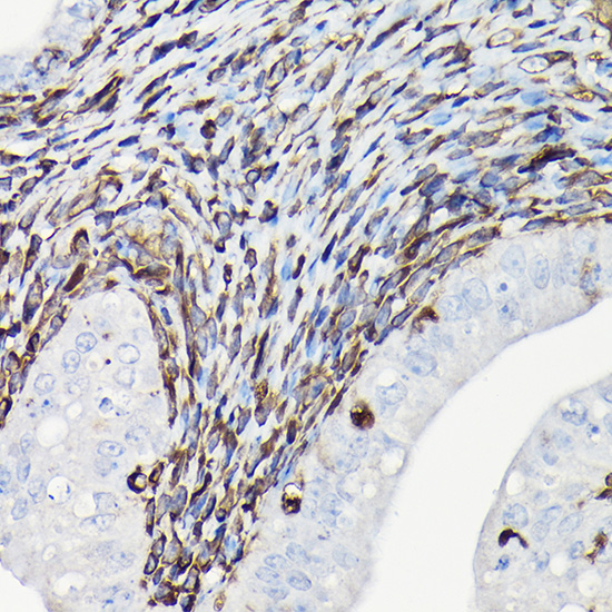 Immunohistochemistry of paraffin-embedded rat uterus using Vimentin Polyclonal Antibody at dilution of 1:100 (40x lens).Perform high pressure antigen retrieval with 10 mM citrate buffer pH 6.0 before commencing with IHC staining protocol.