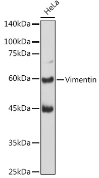 Western blot analysis of extracts of HeLa cells using Vimentin Polyclonal Antibody at 1:1000 dilution.