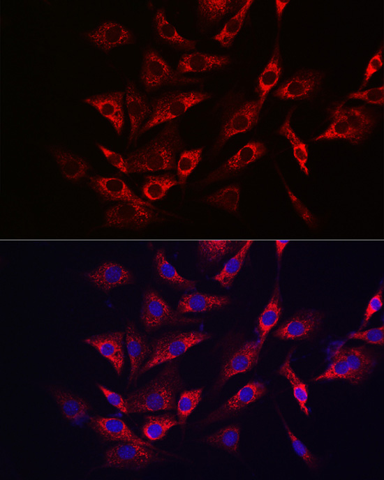 Immunofluorescence analysis of NIH/3T3 cells using [KO Validated] TFEB Polyclonal Antibody at dilution of 1:100 (40x lens). Blue: DAPI for nuclear staining.