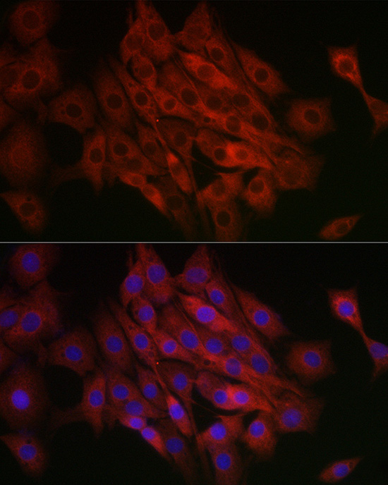 Immunofluorescence analysis of PC-12 cells using [KO Validated] TFEB Polyclonal Antibody at dilution of 1:100 (40x lens). Blue: DAPI for nuclear staining.