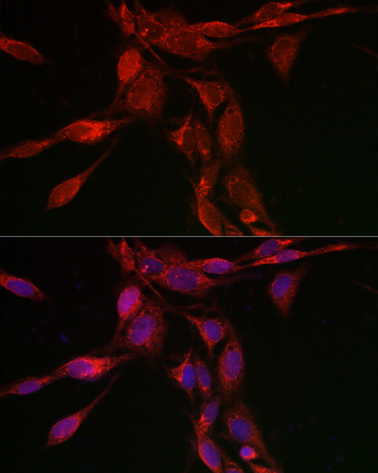 Immunofluorescence analysis of U2OS cells using [KO Validated] TFEB Polyclonal Antibody at dilution of 1:100 (40x lens). Blue: DAPI for nuclear staining.