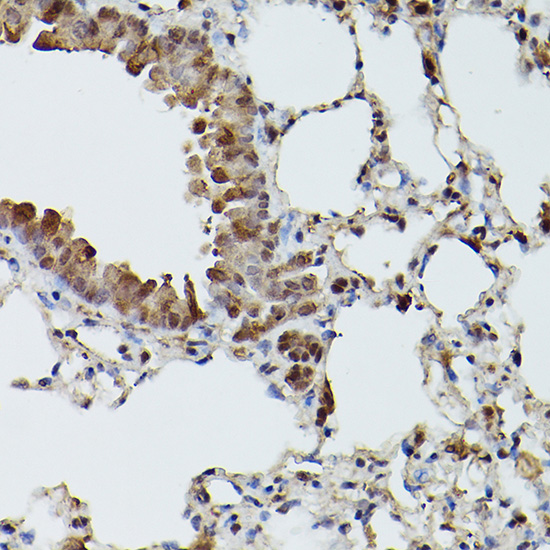 Immunohistochemistry of paraffin-embedded mouse lung using TFEB Polyclonal Antibody at dilution of 1:100 (40x lens).Perform high pressure antigen retrieval with 10 mM citrate buffer pH 6.0 before commencing with IHC staining protocol.