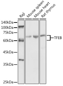 Western blot analysis of extracts of various cell lines using TFEB Polyclonal Antibody at 1:1000 dilution.