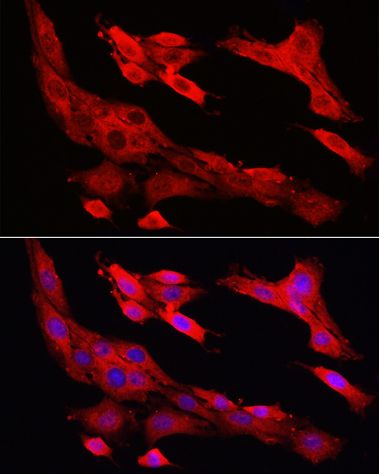 Immunofluorescence analysis of PC-12 cells using [KO Validated] CASP1 Polyclonal Antibody at dilution of 1:100 (40x lens). Blue: DAPI for nuclear staining.