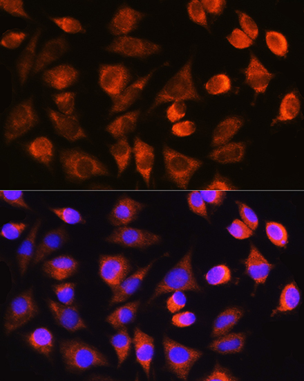 Immunofluorescence analysis of L929 cells using Caspase-3 p17 Polyclonal Antibody at dilution of 1:100. Blue: DAPI for nuclear staining.